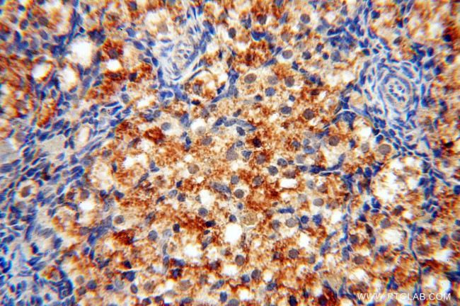 SSH3 Antibody in Immunohistochemistry (Paraffin) (IHC (P))