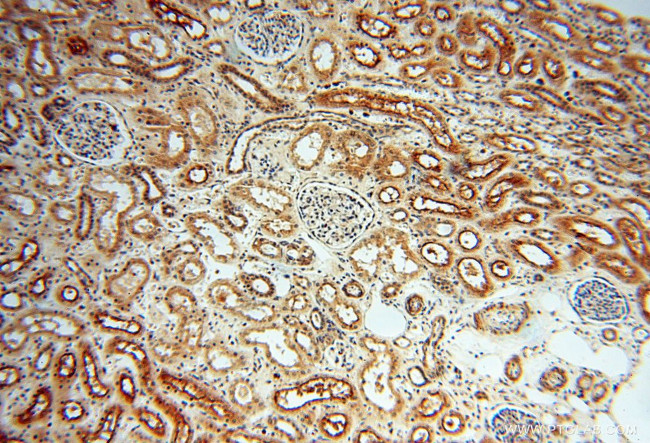 SSH3 Antibody in Immunohistochemistry (Paraffin) (IHC (P))