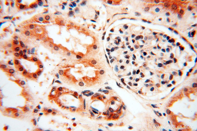 SSH3 Antibody in Immunohistochemistry (Paraffin) (IHC (P))