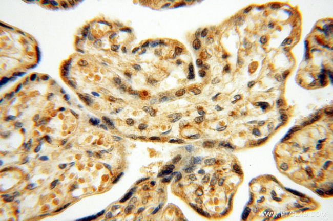 SSH3 Antibody in Immunohistochemistry (Paraffin) (IHC (P))