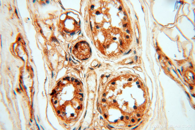 SSH3 Antibody in Immunohistochemistry (Paraffin) (IHC (P))