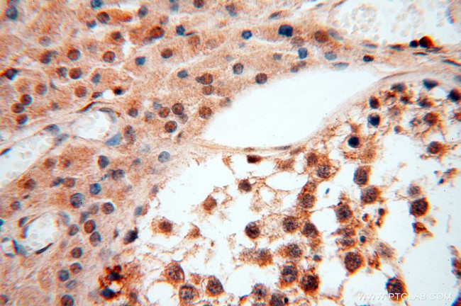 SSH3 Antibody in Immunohistochemistry (Paraffin) (IHC (P))