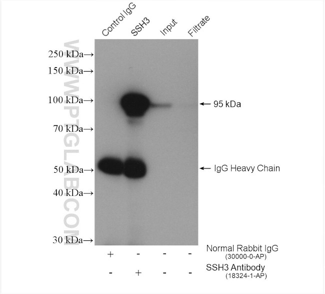 SSH3 Antibody in Immunoprecipitation (IP)
