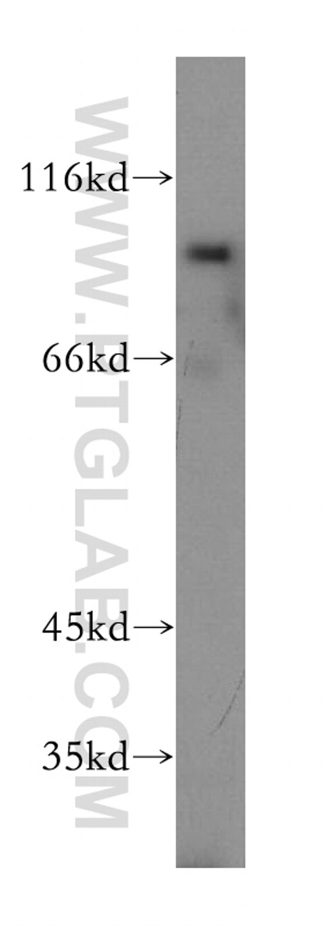 SSH3 Antibody in Western Blot (WB)