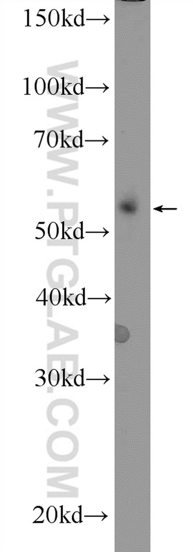 CD24 Antibody in Western Blot (WB)