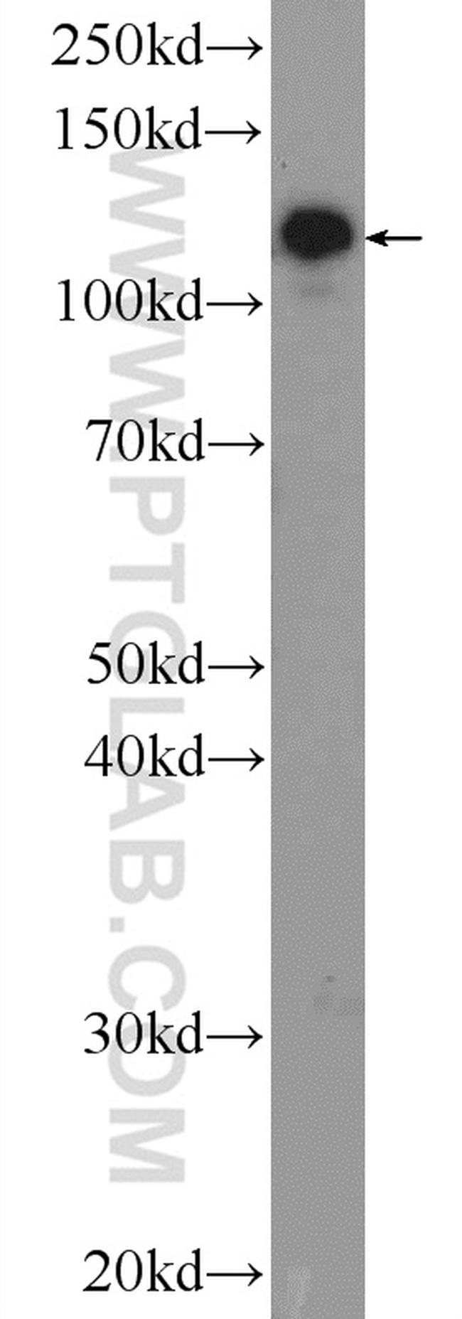 AP3B2 Antibody in Western Blot (WB)