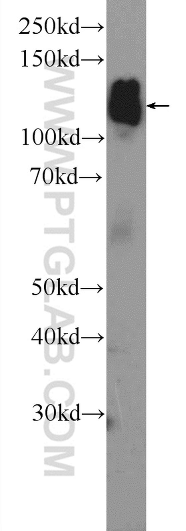 AP3B2 Antibody in Western Blot (WB)