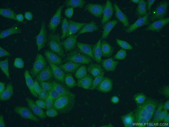 TBC1D22A Antibody in Immunocytochemistry (ICC/IF)