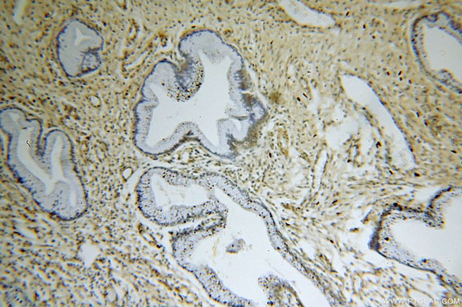 TBC1D22A Antibody in Immunohistochemistry (Paraffin) (IHC (P))