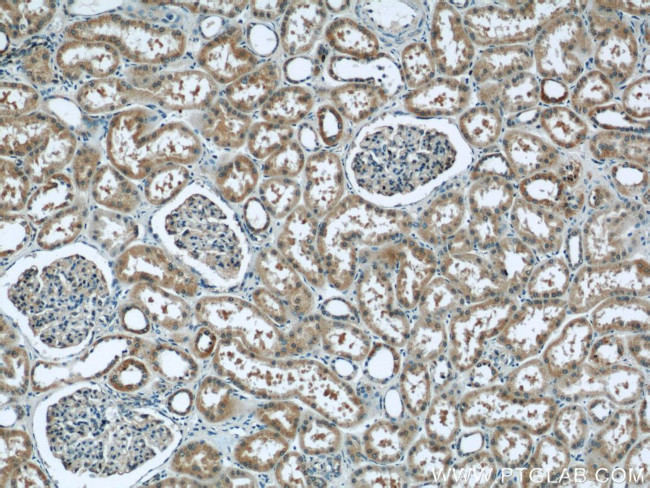 TBC1D22A Antibody in Immunohistochemistry (Paraffin) (IHC (P))