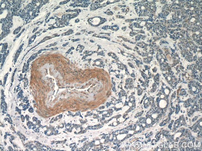 TBC1D22A Antibody in Immunohistochemistry (Paraffin) (IHC (P))