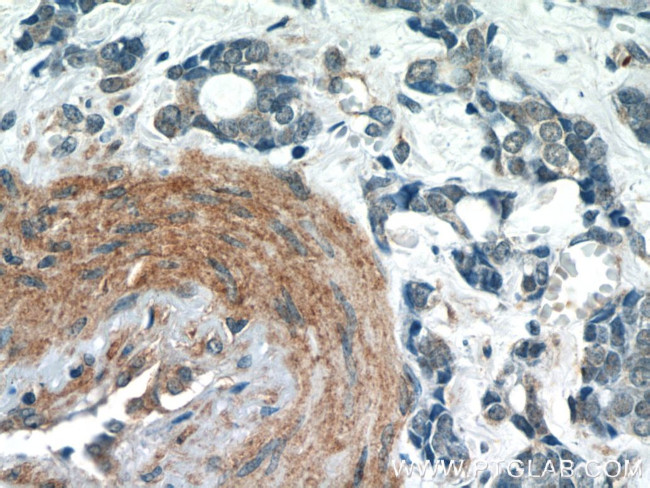 TBC1D22A Antibody in Immunohistochemistry (Paraffin) (IHC (P))