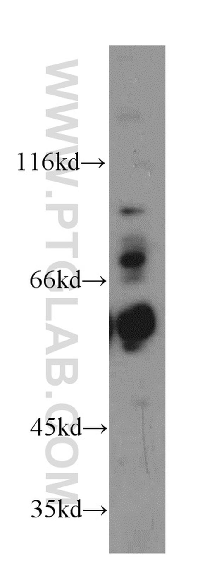 TBC1D22A Antibody in Western Blot (WB)