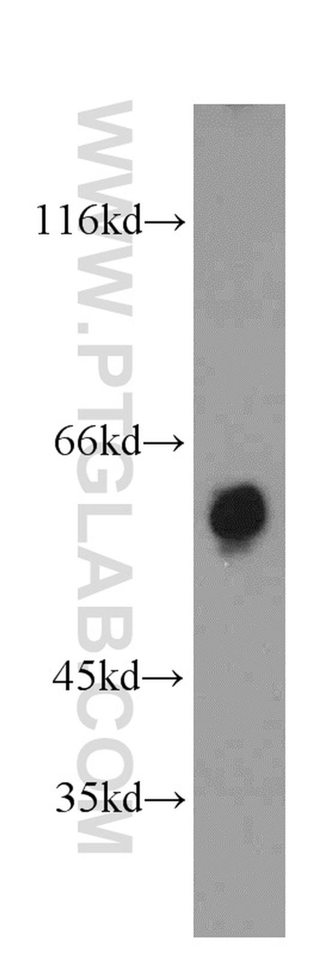 TBC1D22A Antibody in Western Blot (WB)