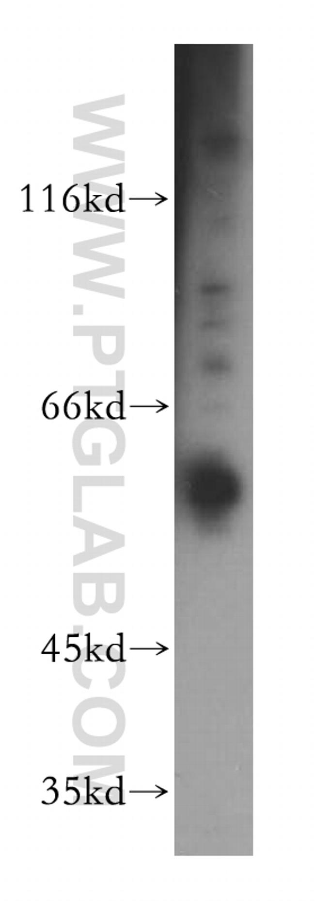 TBC1D22A Antibody in Western Blot (WB)