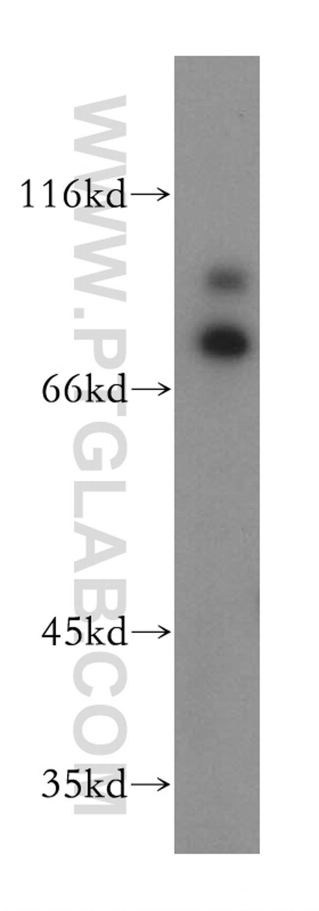 RAD18 Antibody in Western Blot (WB)