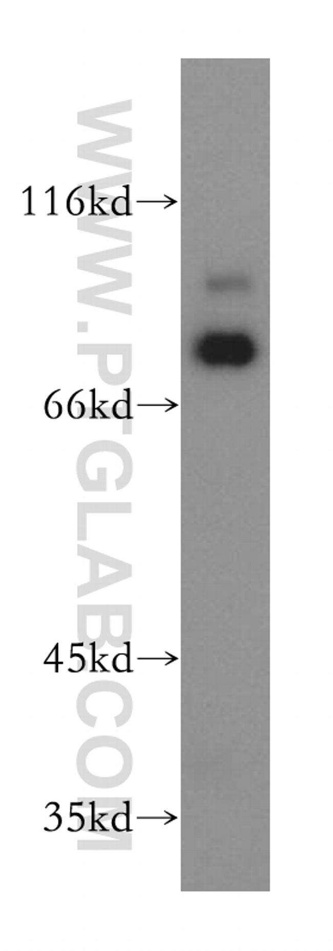 RAD18 Antibody in Western Blot (WB)