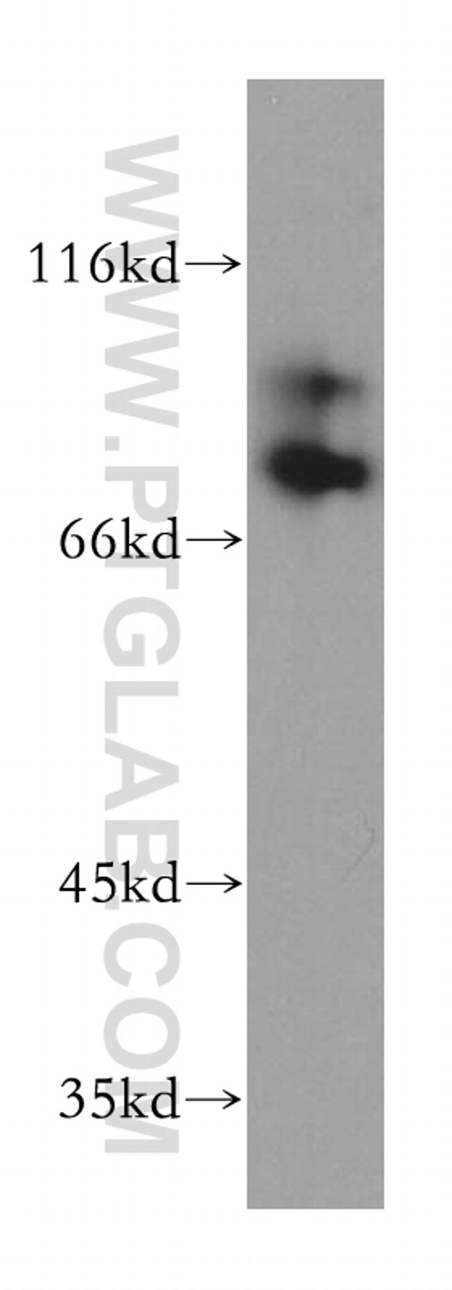 RAD18 Antibody in Western Blot (WB)