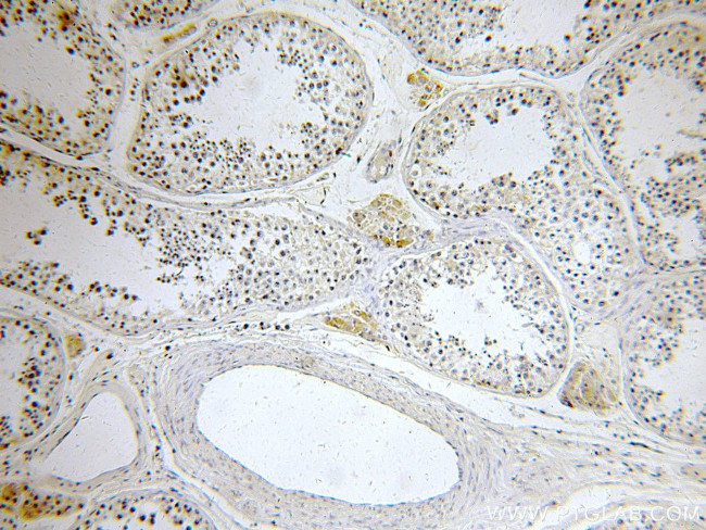 LSM14A Antibody in Immunohistochemistry (Paraffin) (IHC (P))