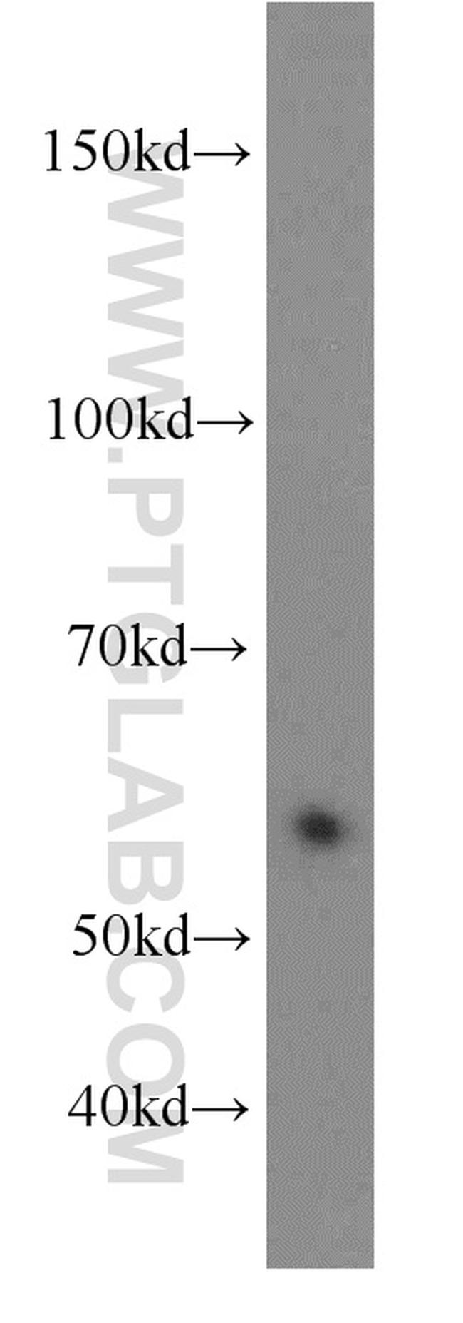 LSM14A Antibody in Western Blot (WB)