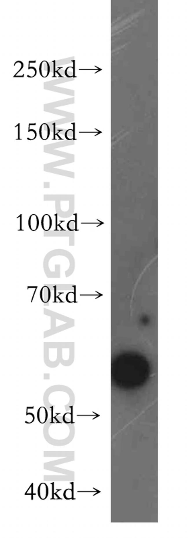 LSM14A Antibody in Western Blot (WB)