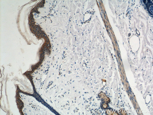 Plakophilin 3 Antibody in Immunohistochemistry (Paraffin) (IHC (P))