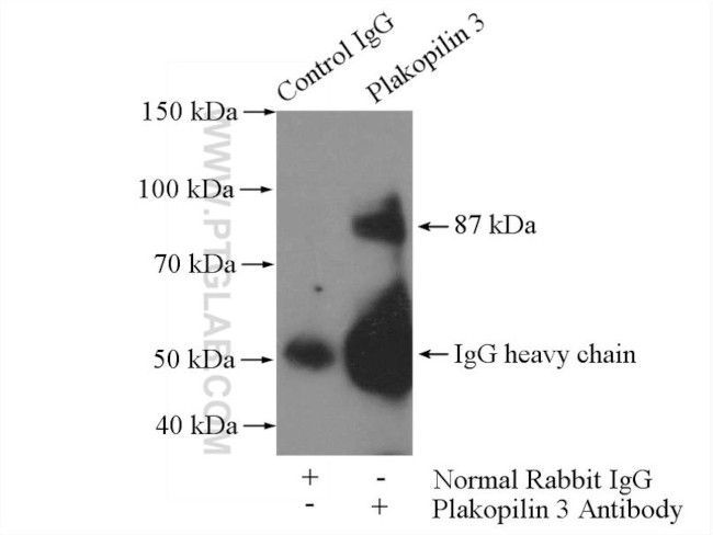 Plakophilin 3 Antibody in Immunoprecipitation (IP)