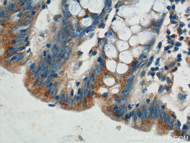 Plakophilin 3 Antibody in Immunohistochemistry (Paraffin) (IHC (P))