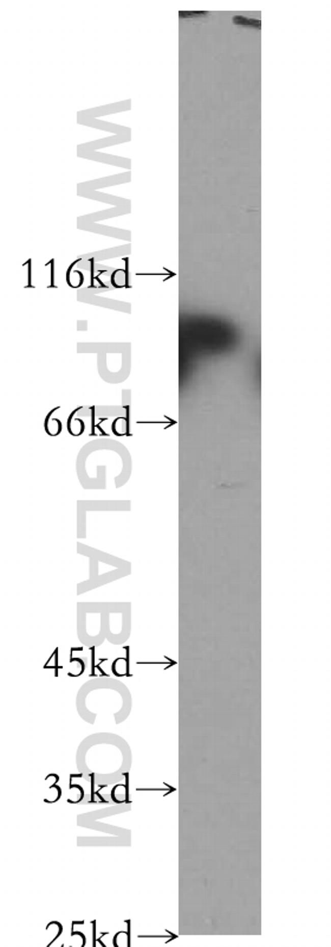 Plakophilin 3 Antibody in Western Blot (WB)