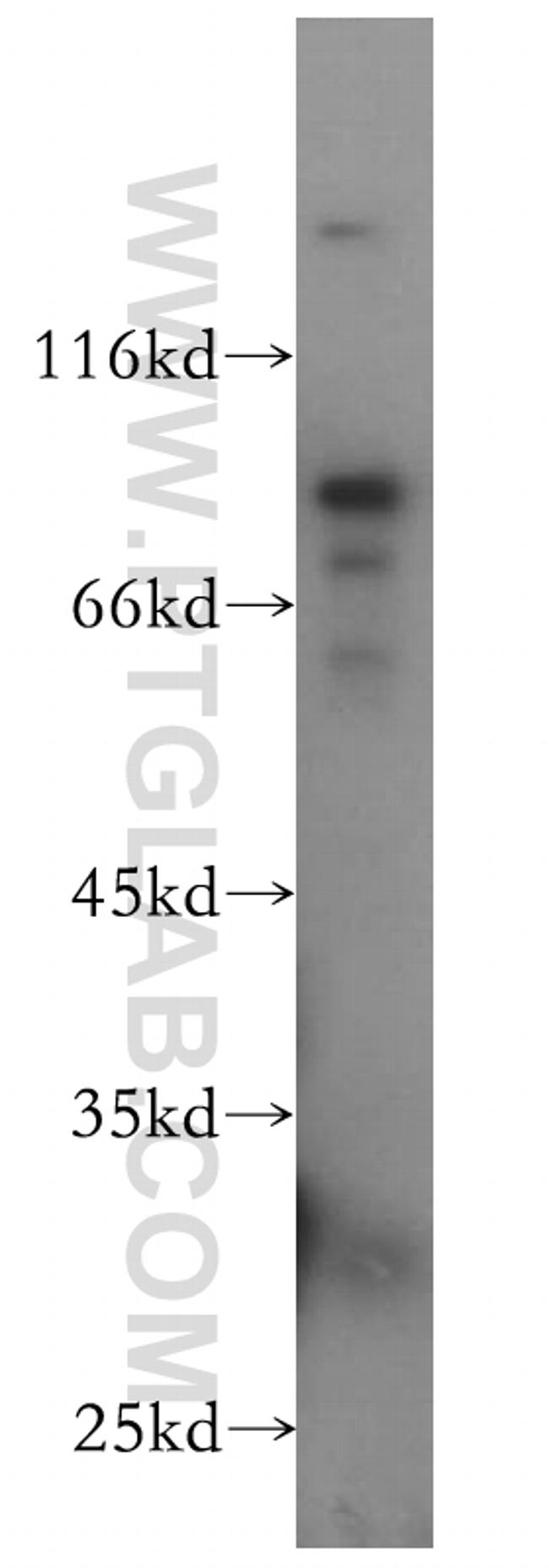 Plakophilin 3 Antibody in Western Blot (WB)