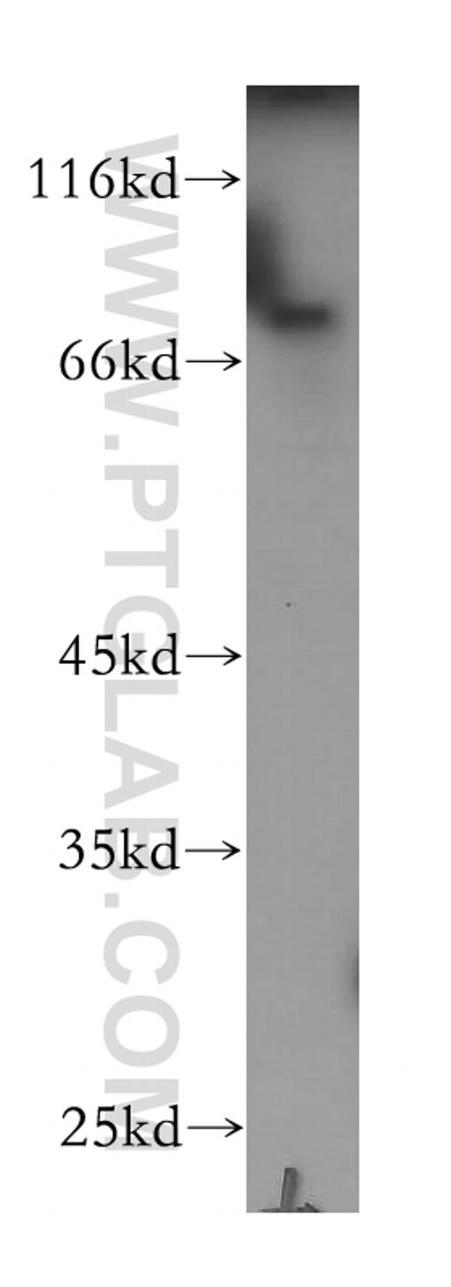 Plakophilin 3 Antibody in Western Blot (WB)