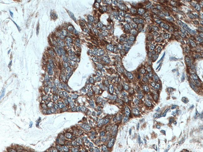 Cytokeratin 10 Antibody in Immunohistochemistry (Paraffin) (IHC (P))