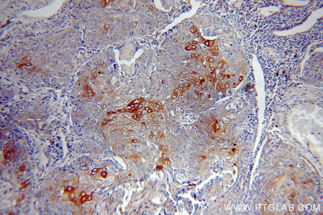 Cytokeratin 10 Antibody in Immunohistochemistry (Paraffin) (IHC (P))