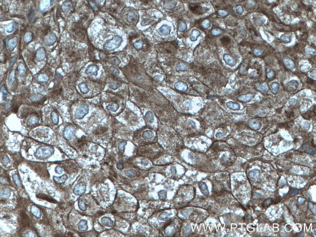 Cytokeratin 10 Antibody in Immunohistochemistry (Paraffin) (IHC (P))