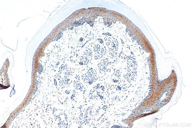 CTNNBIP1 Antibody in Immunohistochemistry (Paraffin) (IHC (P))