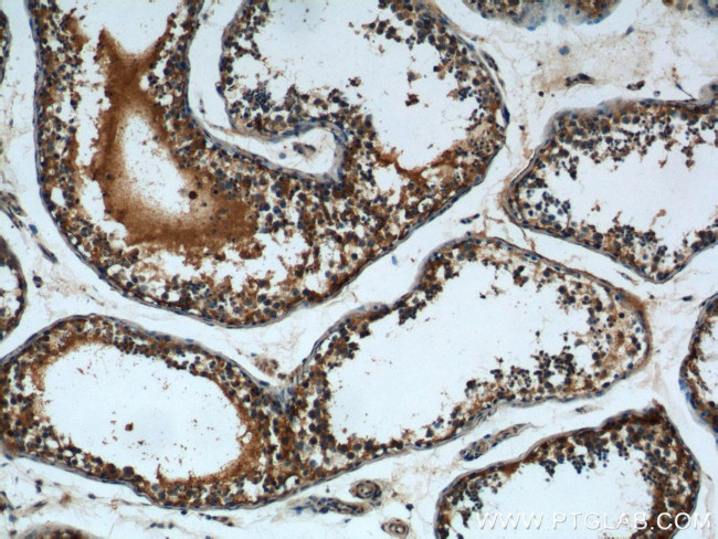 DTX1 Antibody in Immunohistochemistry (Paraffin) (IHC (P))