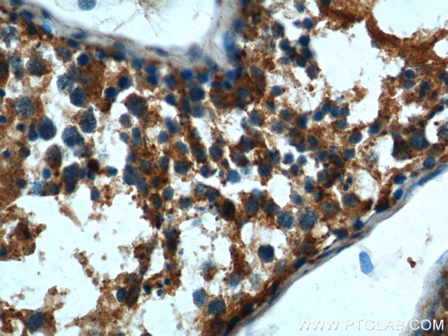 DTX1 Antibody in Immunohistochemistry (Paraffin) (IHC (P))