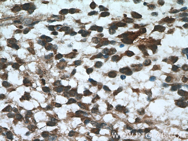 DTX1 Antibody in Immunohistochemistry (Paraffin) (IHC (P))