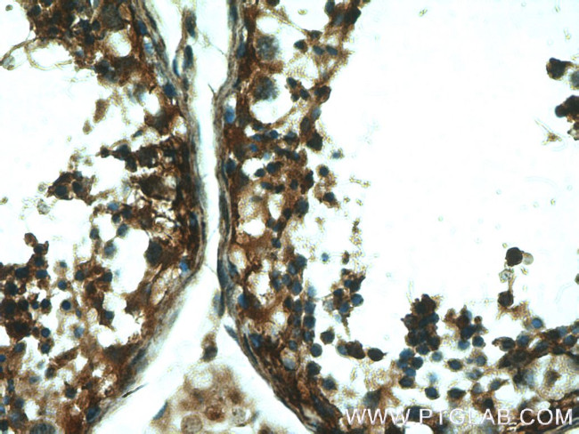 DTX1 Antibody in Immunohistochemistry (Paraffin) (IHC (P))