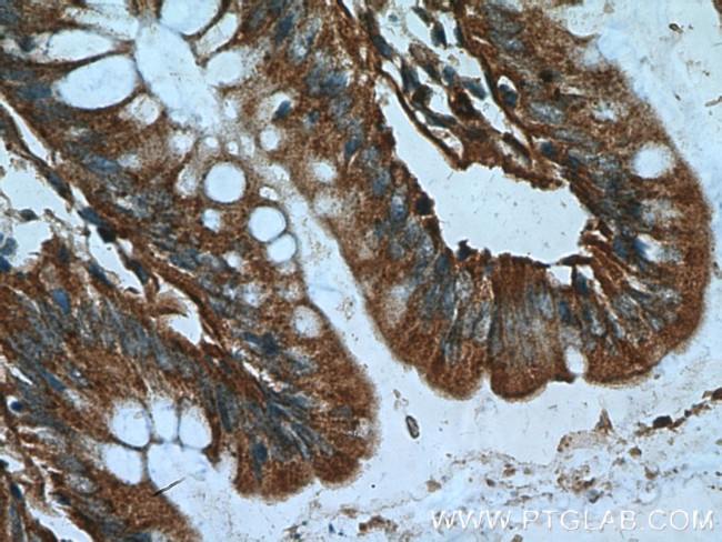 DTX1 Antibody in Immunohistochemistry (Paraffin) (IHC (P))