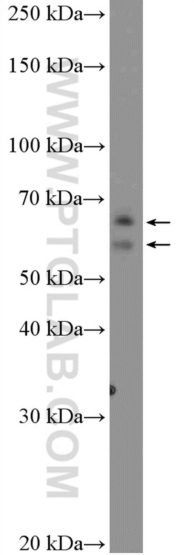 DTX1 Antibody in Western Blot (WB)