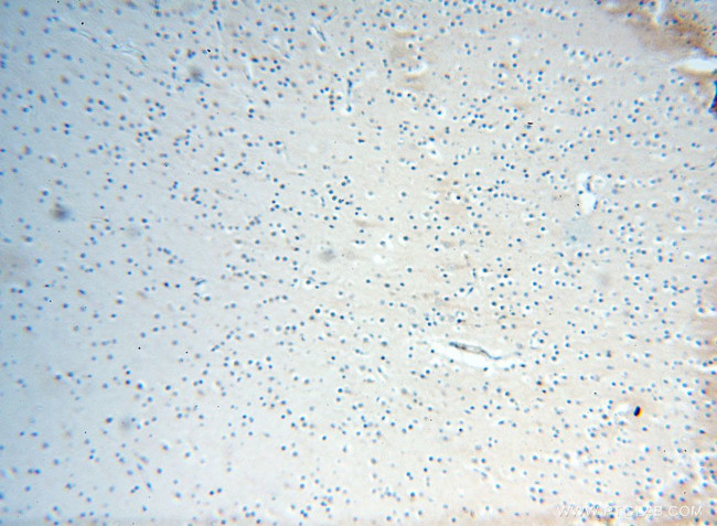 TEX14 Antibody in Immunohistochemistry (Paraffin) (IHC (P))