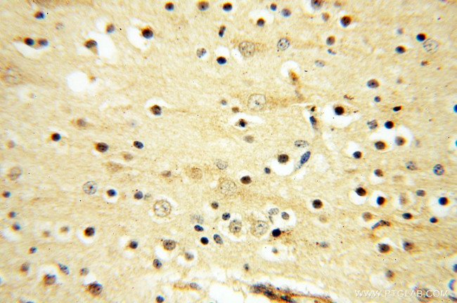 TEX14 Antibody in Immunohistochemistry (Paraffin) (IHC (P))