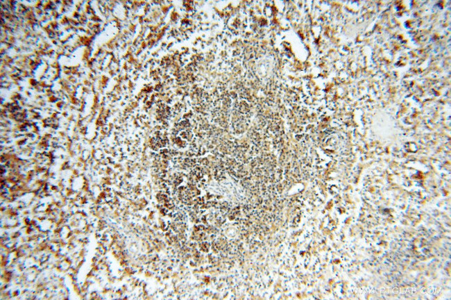 TEX14 Antibody in Immunohistochemistry (Paraffin) (IHC (P))