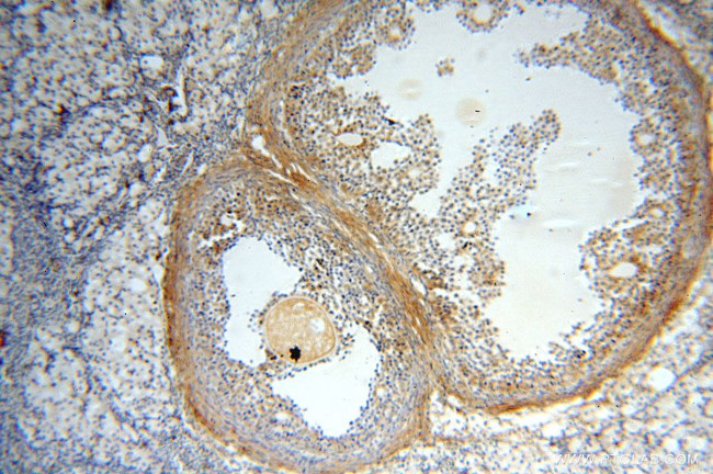 TEX14 Antibody in Immunohistochemistry (Paraffin) (IHC (P))