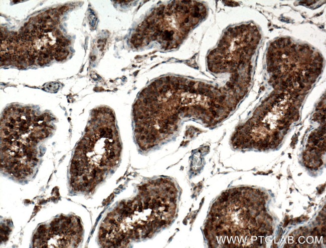 TEX14 Antibody in Immunohistochemistry (Paraffin) (IHC (P))