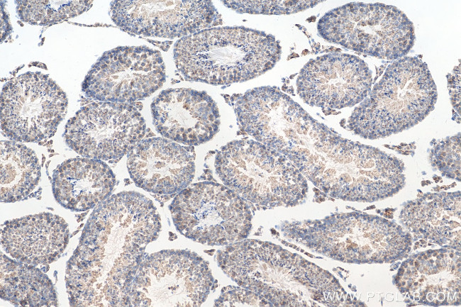 TEX14 Antibody in Immunohistochemistry (Paraffin) (IHC (P))