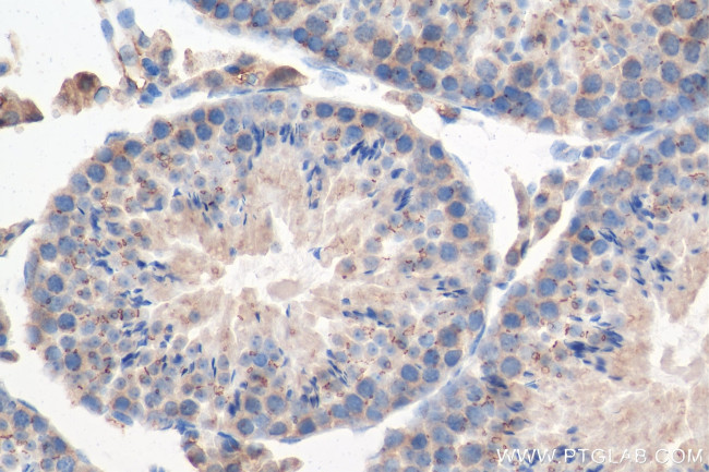 TEX14 Antibody in Immunohistochemistry (Paraffin) (IHC (P))