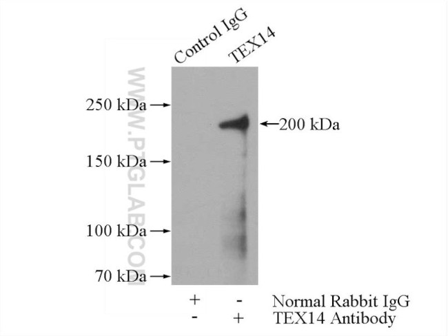 TEX14 Antibody in Immunoprecipitation (IP)