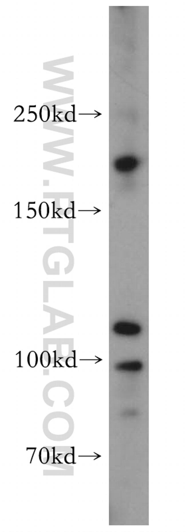 TEX14 Antibody in Western Blot (WB)